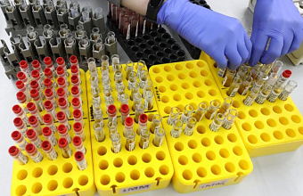 В России создали первый в мире экспресс-тест на гепатит С