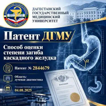Ученые ДГМУ запатентовали новый способ оценки степени загиба каскадного желудка