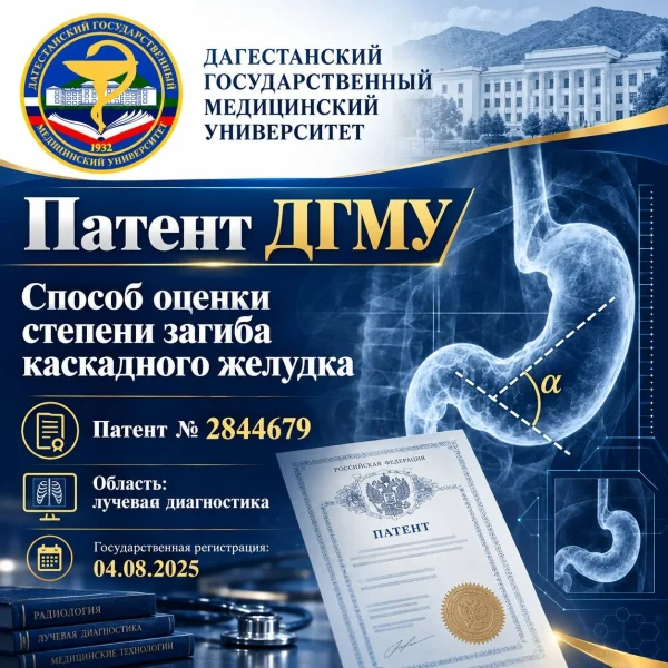 Ученые ДГМУ запатентовали новый способ оценки степени загиба каскадного желудка